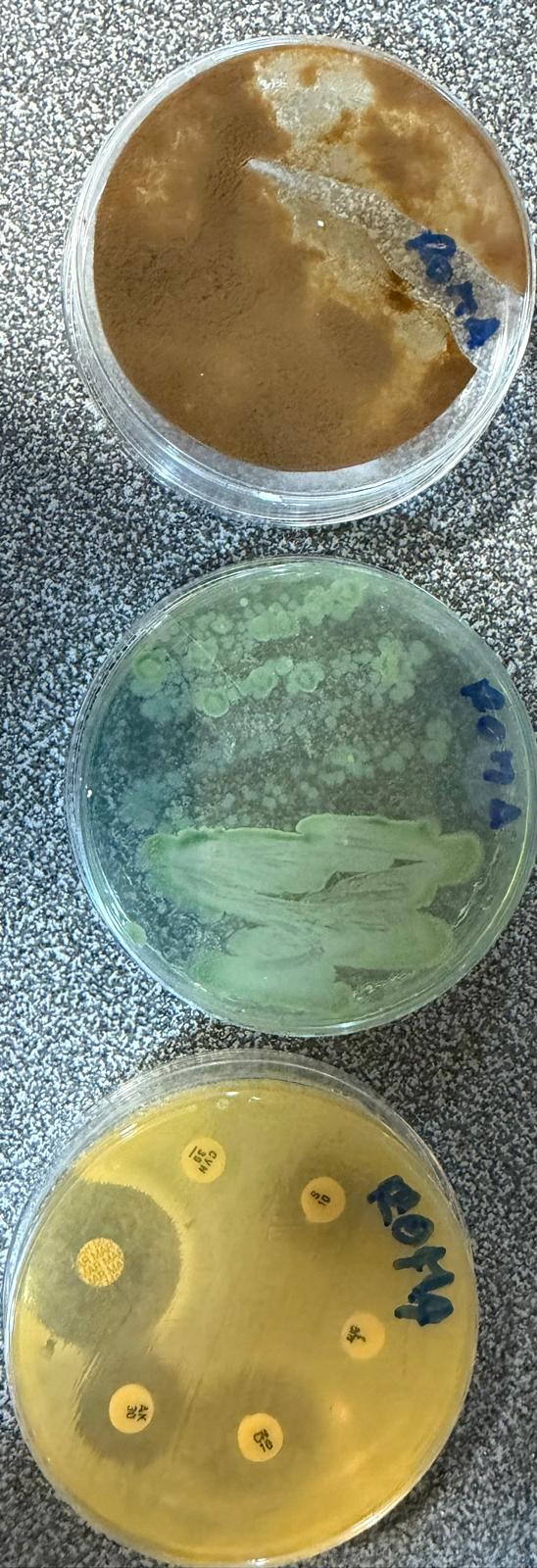 Microbiología / Cultivo y Antibiograma 48 h